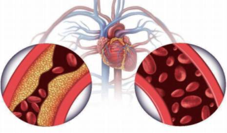 心脑血管疾病检测全系列原料 --心肌钙蛋白T(cTnT) 技术专题